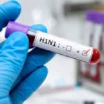 Alarming Surge: Delhi H1N1 Cases Hit 1,344 This Season