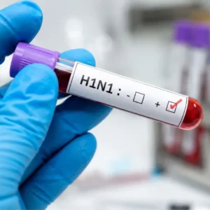 Alarming Surge: Delhi H1N1 Cases Hit 1,344 This Season