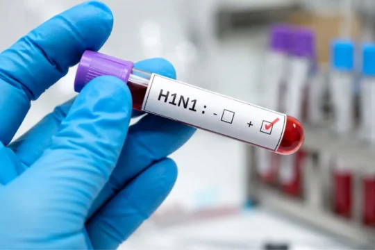 Alarming Surge: Delhi H1N1 Cases Hit 1,344 This Season