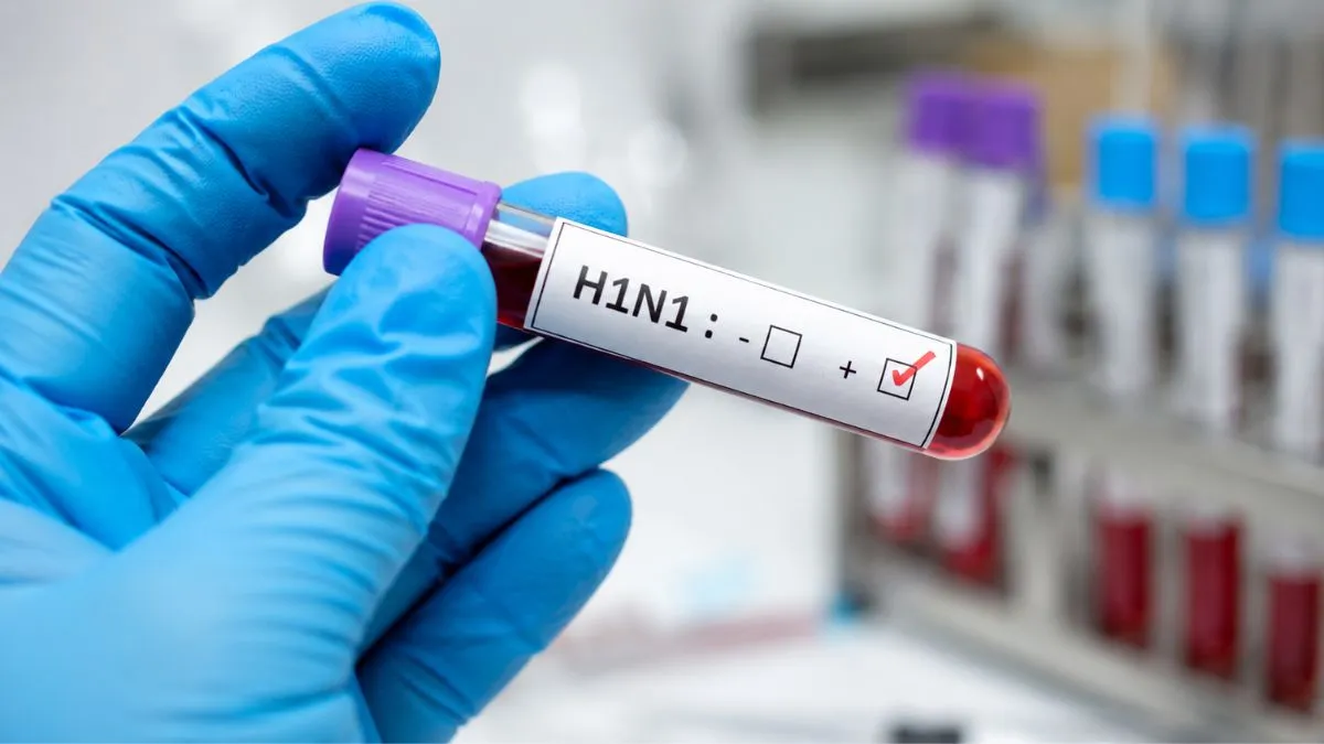 Alarming Surge: Delhi H1N1 Cases Hit 1,344 This Season